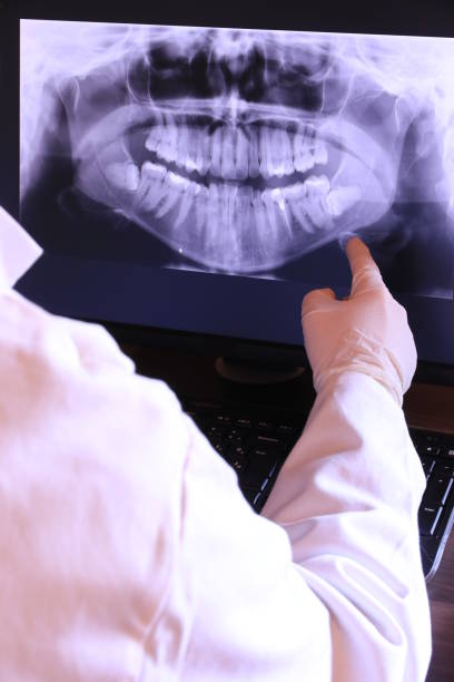 Best Broken or Cracked Tooth Emergency Dentist in Chico, WA
